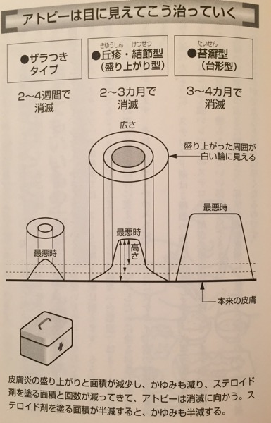 油を断てばアトピーはここまで治る